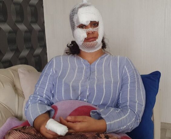 Diyarbakır’da çocuğunun doğum gününde eşi bıçakladı