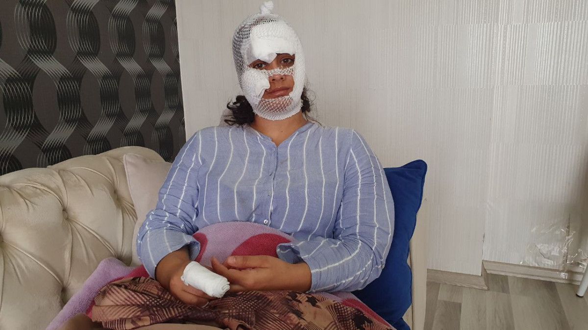 Diyarbakır da çocuğunun doğum gününde eşi bıçakladı #3