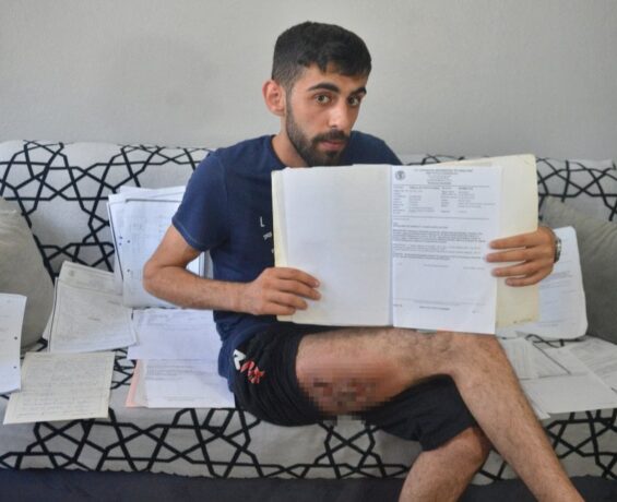 Adana’da şaka kurbanı Abdullah, 12 yıldır geçmeyen yarasına deva arıyor