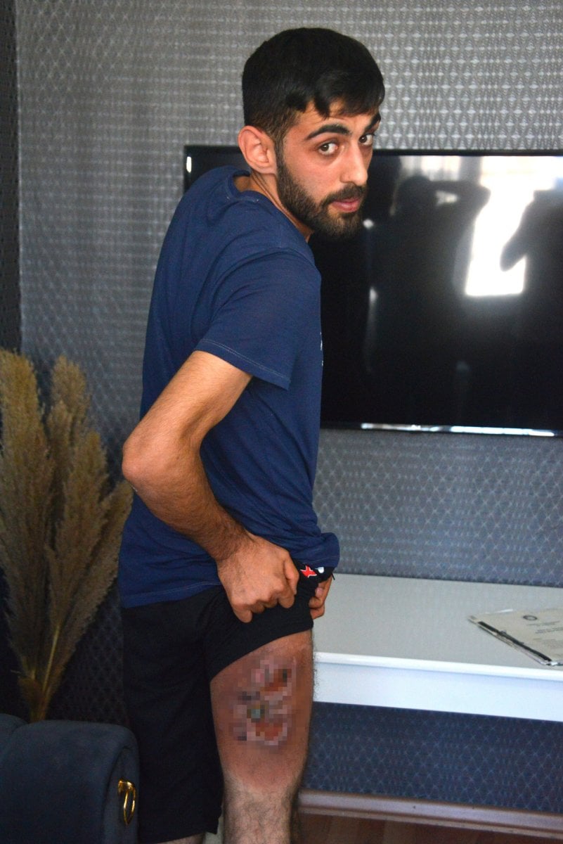 Adana da şaka kurbanı Abdullah, 12 yıldır geçmeyen yarasına çare arıyor #2