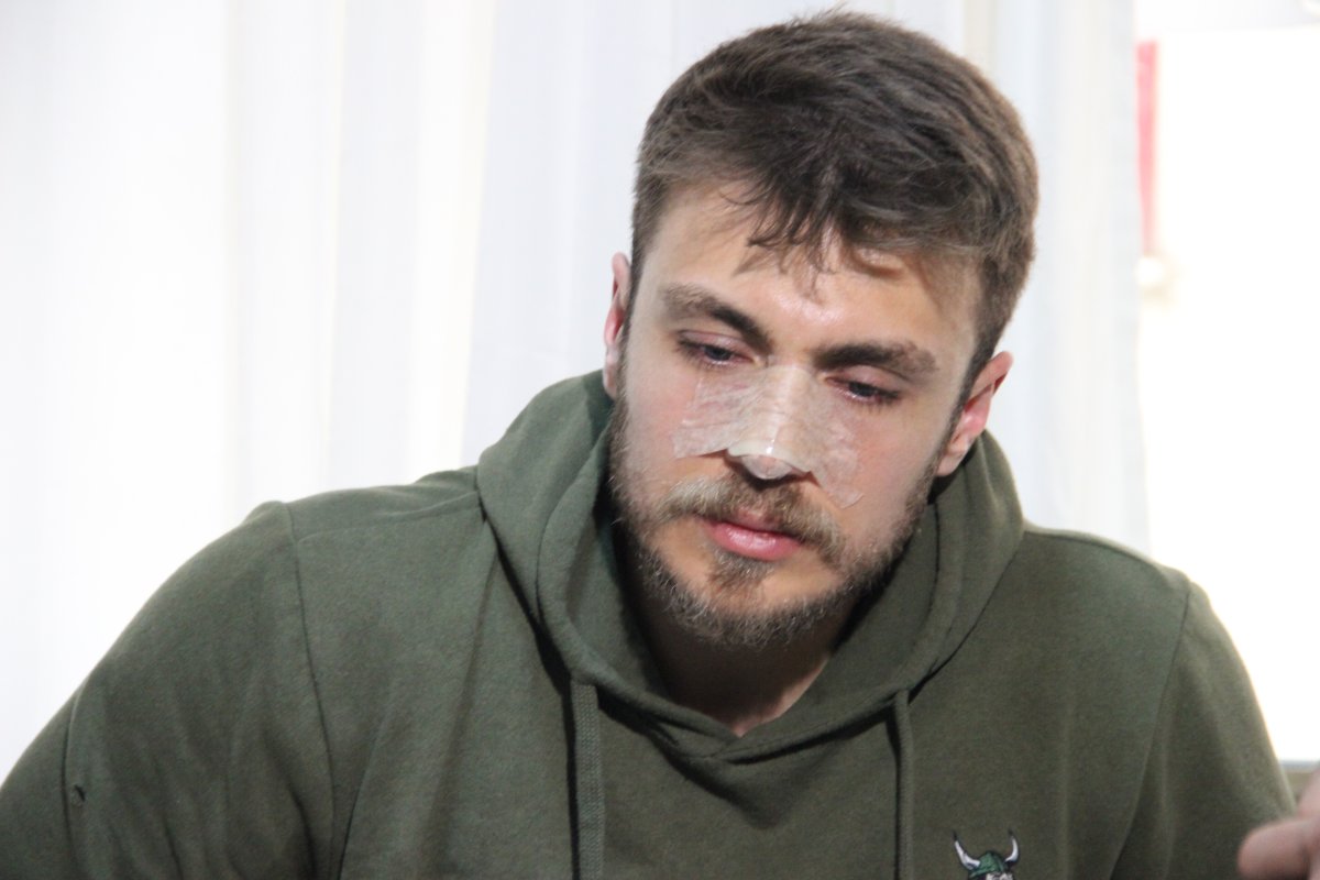 İzmir’de doktorun burnunu kıran şüpheli tutuklandı #2