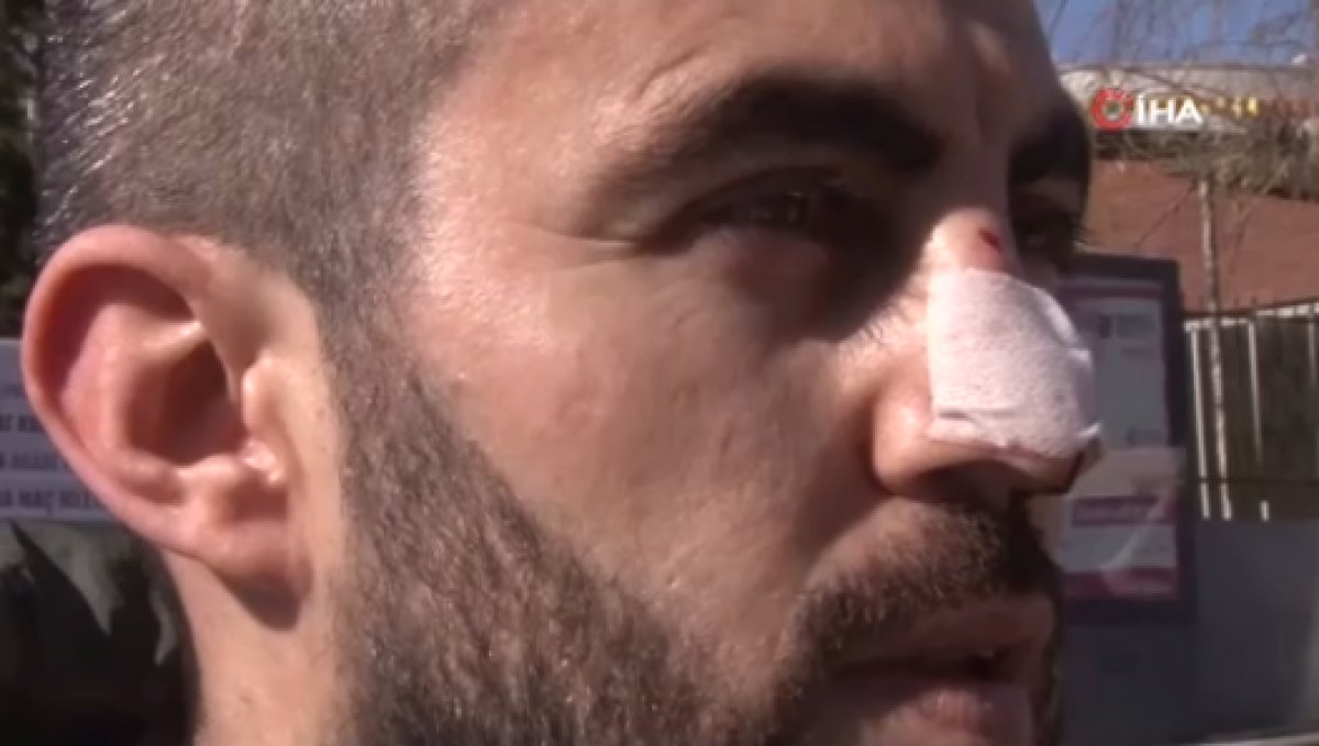 Ümraniye’de sağlık çalışanının burnunu kıran sanık: Beni tahrik etti #2