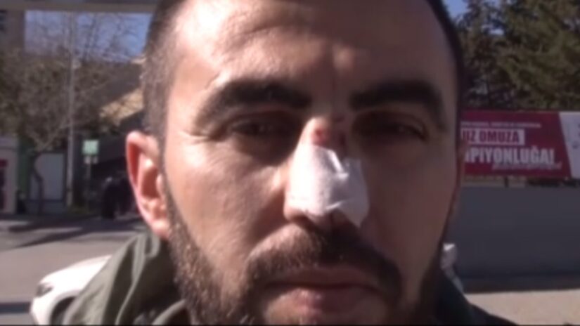 Ümraniye’de sağlık çalışanının burnunu kıran maznun: Beni tahrik etti